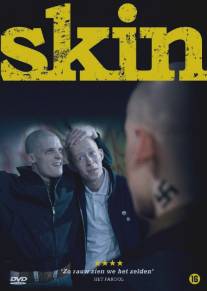 Скин/Skin (2008)