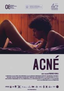 Угри/Acne (2008)